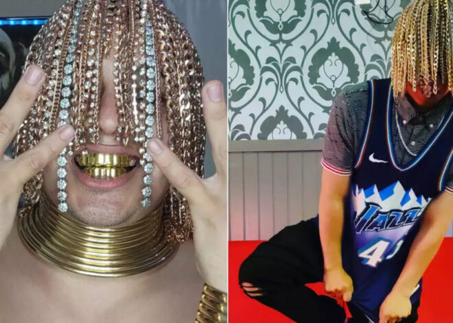 Rapper Dan Sur’s Unconventional Style: Gold Chains Surgically Implanted in His Head