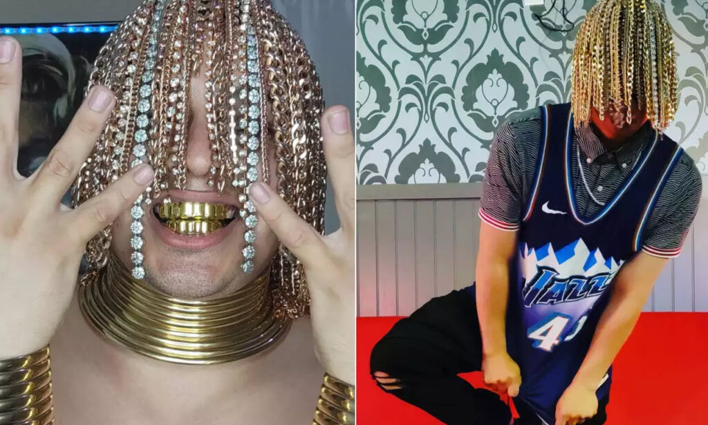 Rapper Dan Sur’s Unconventional Style: Gold Chains Surgically Implanted in His Head