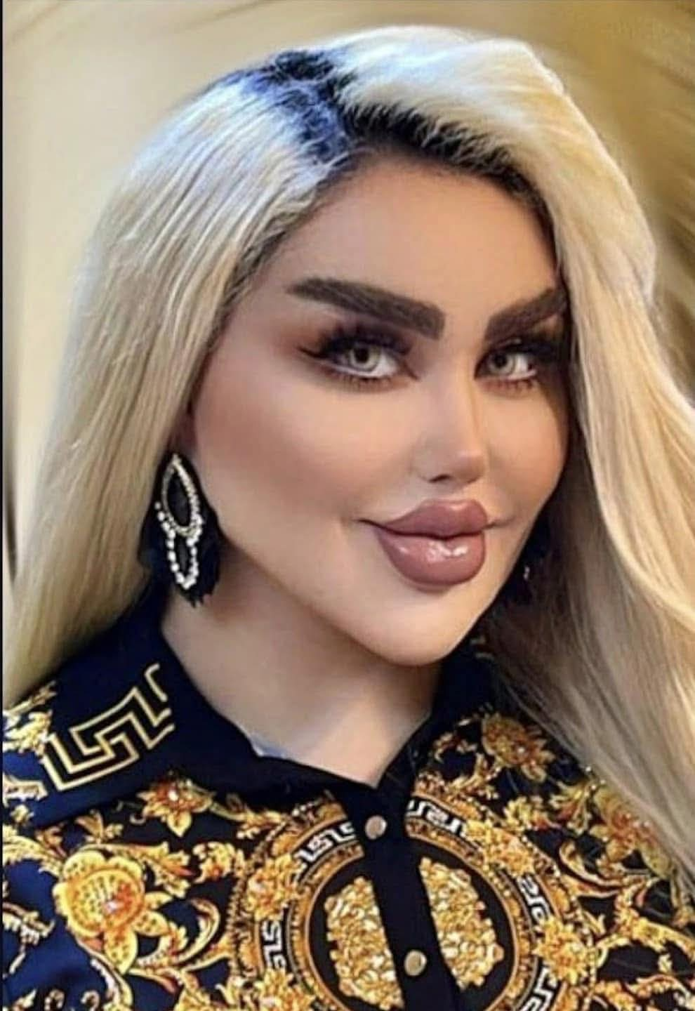 She Had 43 Cosmetic Procedures To Become A Barbie Doll – But Critics Say She Look Like A ‘Zombie’